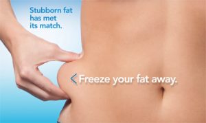 Freeze your fat