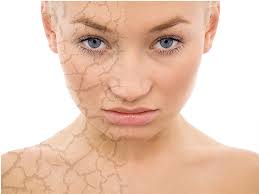micro needling